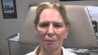 Sculptra&reg; Injections  by  NYC Dermatologist Dr. Ron Shelton