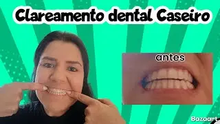 Clareamento Dental Caseiro - super f&aacute;cil e muito eficaz 