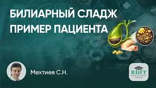 Клинический пример пациента с билиарным сладжем