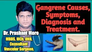 Gangrene Causes , Symptoms, Diagnosis and Treatment | Contact number 7972622112