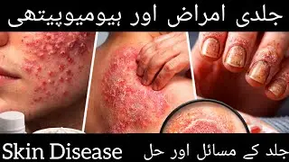 Skin Diseases| Skin problems & Solutions| Understanding of Skin Diseases| جلد کی عام بیماریاں۔ علاج 