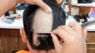 Old School Barber Skills Clean Head Shave Transformation Attractive Dandruff Head 🔥