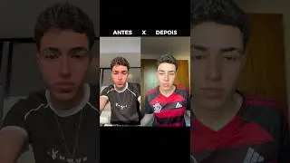 FIZ HARMONIZA&Ccedil;&Atilde;O FACIAL COM A DRA ALICIA