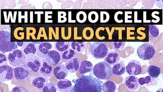 WHITE BLOOD CELLS - GRANULOCYTES | Dr.Sonu Yadav | Pathology Kingdom | Haematology