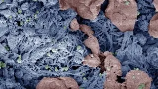 Nanoparticles that speed blood clotting may someday save lives