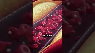 A Machine That Can Remove Cholesterol Plaques 😯😱#science #history #space #historicfacts #facts