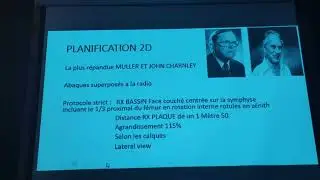 Planification 2D : reste il un intérêt ?