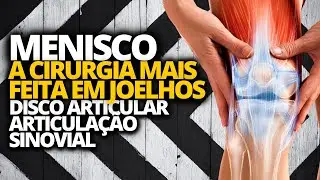 DISCO ARTICULAR MENISCO - ARTICULA&Ccedil;&Atilde;O SINOVIAL