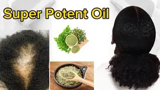 ONLY 2 INGREDIENTS AND YOUR HAIR WILL NEVER STOP GROWING | GROW LONG, THICK AND HEALTHY HAIR
