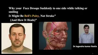 Bell&rsquo;s palsy ( one side facial weakness with face drooping down while talking). Don&rsquo;t Panic