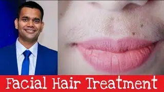 Facial Hair Treatment - How To Get Facial Hair Removed Permanently