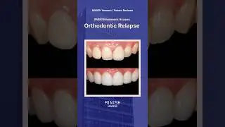 Orthodontic Relapse Case Review