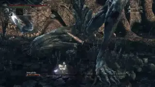 Bloodborne: Nightmare Frontier [Walkthrough]