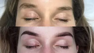 AMAZING TRANSFORMATION! TrueBrow&trade; Fixes Crooked Brows