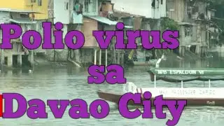 Polio virus sa Davao city#09-23-2019