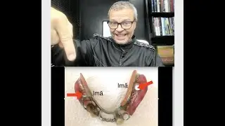 PRÓTESE COM IMÃS: MAIS OSSO E RETENÇÃO!