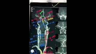 MR VENOGRAM VS MR ANGIOGRAPHY (MRI) - BASIC ANATOMY