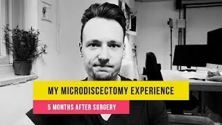 My Microdiscectomy Back Surgery Experience: 5 MONTHS AFTER SURGERY | L4L5 | Slipped Disc