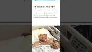 Guy Whittall survive leopard attack 👈😲🤔 #shorts #viral #guywhittall