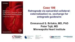 Case 106: Manual of CTO interventions: Retrograde via epicardial collateral