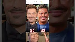 What Happened To Zac Efron?😳  #viral #shorts #funnyimages comedy #fyp #subscribe