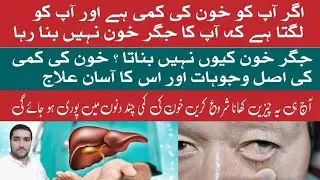 Why liver do not produce blood ? Jigar khoon na banaye to kya kare ? khoon ki kami ka ilaj in urdu