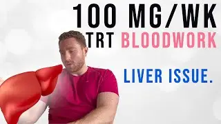 My Blood Work on 100mg Testosterone per Week