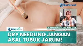 Risiko Dry Needling dan Pentingnya Dilakukan oleh Ahli: Dokter Jelaskan Fakta Medisnya