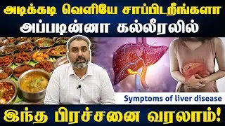 மேல் வயிறு வலிச்சா அதுக்கு காரணம் கல்லீரலா? | Symptoms of liver disease | Samayam Tamil Lifestyle