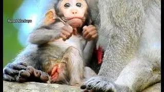 Update 11-12-18: Poor baby Janet's wound nearly heal,Good job Jane keep Janet's wound Cleaned