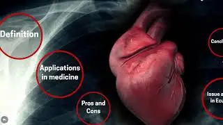 Catheter Ablation for Ventricular Arrhythmias