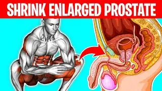 Top 4 Best Exercises for Your Enlarged Prostate