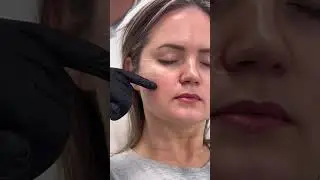 RRS&reg; HA Long Lasting &ndash; Jaunās paaudzes hibrīdpreparāts