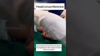 Как измерить окружность головы у новорожденного | детский врач #новорожденный #шорты #видео о дет...