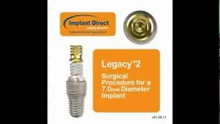 Legacy2 - 7mm