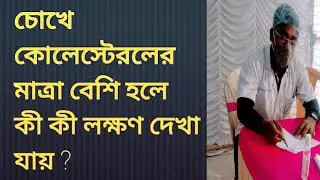 High Cholesterol | Sign and Symptoms in Eye | চোখে উচ্চ কোলেস্টেরল চিহ্ন