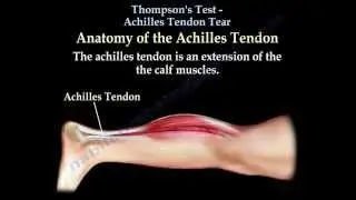 Thompson's Test Achilles Tendon Tear - Everything You Need To Know - Dr. Nabil Ebraheim