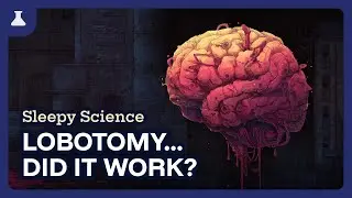 Lobotomy: Fall Asleep Learning About Medicine's Darkest Chapter