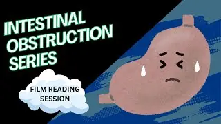 Intestinal Obstruction Cases - Film Reading Session