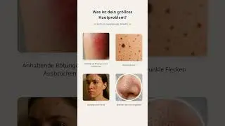 Dein gr&ouml;&szlig;tes Hautproblem?