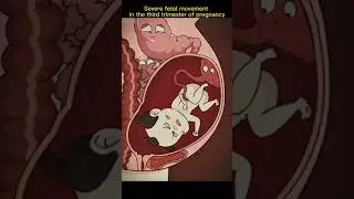 third trimester of pregnancy