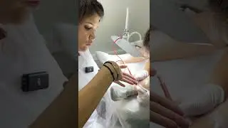 Никогда не ставьте так руку вы точно вводите иглу неправильно. Голень Электроэпиляция практика.