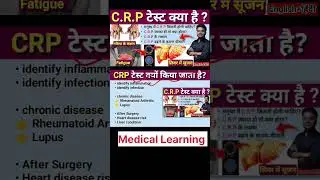 CRP Test In Hindi | CRP Test Kya Hota hai | C Reactive Protein Test #shorts #crptest  #bloodtest