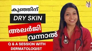 Dry Skin allergy | Dry SKin in Babies |Atopic Dermatitis | കുട്ടികളിലെ വരണ്ട ചർമം