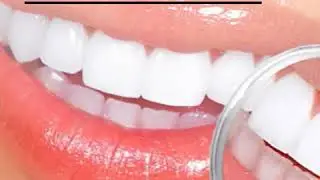 Whitenipen &trade; Teeth Whitening Pen