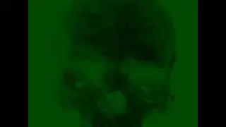 Iesope Drift-compiled by the skullzcum