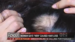 Aberdeen woman claims 