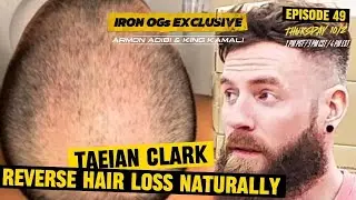 How to Prevent & Reverse Hair Loss Naturally! #HairLoss #HairRegrowth #HairGrowth
