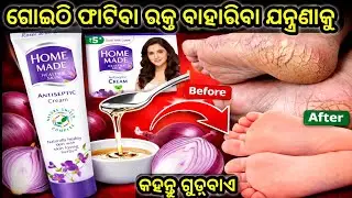 ମାର୍କେଟର ଦାମୀ କ୍ରିମ୍ କିଣିବା ବନ୍ଦ କରନ୍ତୁ ଗୋଡ଼ ଫଟା ଯନ୍ତ୍ରଣାରୁ ମୁକ୍ତିପାଆନ୍ତୁ‼️Homemade Crack Heal Cream