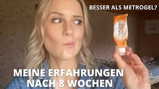 ROSAZEA-Serie | FOLGE 9: SKINOREN CREME REVIEW | Meine Erfahrung + Anwendung